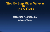 Step-by-step on How to Do a Mitral Valve-In-Ring TMVR: Tips and Tricks