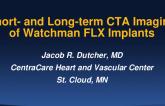 TCT 194: Short- and Long-term CTA Imaging of Watchman FLX Implants