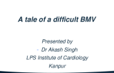 TCT 958: A tale of a difficult BMV : Through the Transjugular route in Interuppted IVC