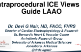 Key Intraprocedural ICE Views to Guide LAAO (case examples)
