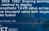 TCT 1562: Snaring Technique as a Method to Deploy Bioprosthetic Transcatheter Aortic Valve (TAVR) Across a Native Bicuspid Valve With Atypical Leaflet Fusion