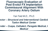 TCT 833: Fluoroscopic Evaluation of Post Evolut FX Implantation Commissural Alignment With Coronary Artery Ostium