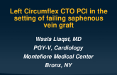 Left Circumflex CTO PCI in the Setting of Failing Saphenous Vein Graft