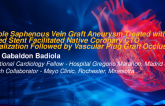 TCT 909: Unstable Saphenous Vein Graft Aneurysm Treated with Covered Stent Facilitated Native Coronary CTO Recanalization Followed by Vascular Plug Graft Occlusion 