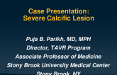 Case Presentation: Severe Calcific Lesion