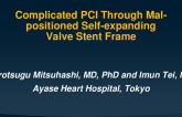 TCT 1085: Complicated PCI Through Mal-positioned Self-expanding Valve Stent Frame
