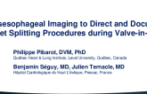 Trans-Esophageal Imaging to Direct and Document Leaflet Splitting Procedures During Valve-in-Valve TAVR