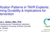 TCT 396: Calcification Patterns in TAVR Explants: Informing Durability & Implications for Reintervention  
