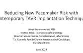 A Practical Guide to Reduce Conduction Disturbance After TAVR