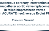 TCT 519: Coronary access and percutaneous coronary intervention feasibility after transcatheter aortic valve replacement in failed bioprosthetic valves with ACURATE neo2 versus Evolut PRO+