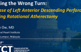 TCT 1409: Taking the Wrong Turn: A Case of Left Anterior Descending Perforation During Rotational Atherectomy
