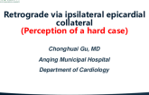 TCT 1121: Retrograde via Ipsilateral Epicardial Collateral: Perception of a Hard Case