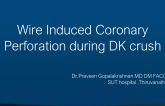 TCT 1301: Wire Induced Coronary Perforation During DK Crush