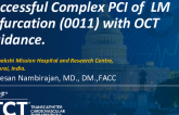 TCT 1130: Successful Complex PCI of LM Trifurcation (0011) With OCT Guidance