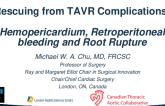 Dealing With Hemopericardium, Retroperitoneal Bleeding, and Annular Disruption