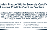 TCT 391: Lipid-rich Plaque Within Severely Calcified Lesions Predicts Calcium Fracture