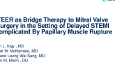 TCT 1017: MitraClip as Bridge Therapy to Mitral Valve Surgery in the Setting of Delayed STEMI Complicated By Papillary Muscle Rupture