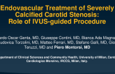 TCT 310: Endovascular Treatment of Severely Calcified Carotid Stenosis: Role of IVUS-Guided Procedure