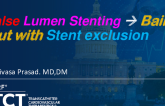 TCT 1452: False Lumen Stenting: Bailed Out With Stent Exclusion