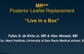 Case Presentation: Transcatheter Posterior Leaflet Restoration (Polaris)