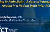 TCT 1271: Hiding in Plain Sight : A Case of Vasospastic Angina in a Patient With Prior PCI