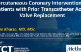 TCT 834: Percutaneous Coronary Interventions in Patients With Prior Transcatheter Aortic Valve Replacement