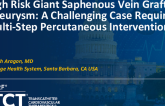 TCT 1287: High Risk Giant Saphenous Vein Graft Aneurysm: A Challenging Case Requiring Multi-Step Percutaneous Intervention