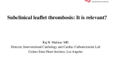 Subclinical Leaflet Thrombosis: A Benign Imaging Finding or Something More