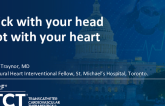 TCT 1282: Stick With Your Head, Not Your Heart: Percutaneous Snare Retrieval of Embolized Cyanoacrylate Glue From the Heart