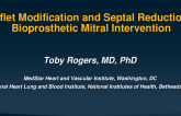 Leaflet Modification and Septal Reduction in Bioprosthetic Mitral Intervention (When and Why)