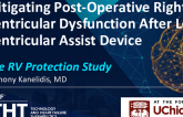 Mitigating Post-Operative Right Ventricular Dysfunction After Left Ventricular Assist Device: The RV Protection Study