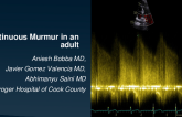 Continuous Murmur: A Case of Patent Ductus Arteriosus in Adult