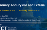 Case Presentation 1: Coronary Aneurysms and Ectasia