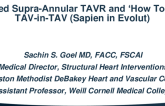 Case Presentation 1: Failed Supra-Annular TAVR and ‘How To Do’ TAV-in-TAV (Sapien in Evolut)