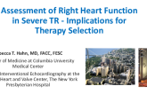 Assessment of Right Heart Function in Severe TR - Implications for Therapy Selection