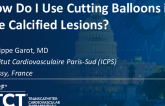 How Do I Use Cutting Balloons in the Calcified Lesions?