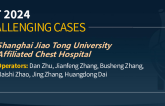 TCT 1354: Challenging Case