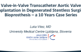 TCT 478: Valve-in-Valve Transcatheter Aortic Valve Implantation in Degenerated Stentless Surgical Bioprothesis – a 10 Years Case Series