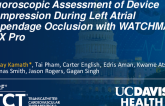 TCT 530: Fluoroscopic Evaluation of Device Compression During Left Atrial Appendage Occlusion With WATCHMAN FLX Pro