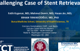 TCT 1582: A Challenging Case of Stent Retrieval