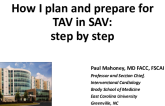 How do I plan and prepare for TAV-in-SAV?