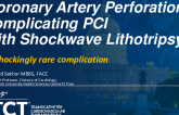 TCT 1578: Coronary Artery Perforation Complicating Percutaneous Coronary Intervention With Shockwave Lithotripsy for Severely Calcified Coronary Calcification
