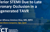 TCT 1382: Inferior STEMI Due to Late Coronary Occlusion in a Degenerated TAVR