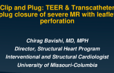 Clip and Plug: TEER & Transcatheter Plug Closure of Severe MR With Leaflet Perforation