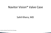 Navitor Vision Valve Case