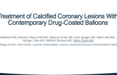 TCT 280: Treatment of Calcified Coronary Lesions With Contemporary Drug-Coated Balloons