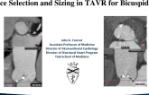 Device Selection and Sizing in TAVR for Bicupsid AS