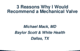 3 Reasons Why… I Would Recommend a Mechanical Valve