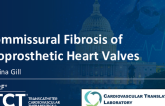TCT 952: Identification and Analysis of Commissural Fibrosis of Bioprosthetic Heart Valve Explants: A Novel Mechanism of Bioprosthetic Stenosis