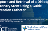 TCT 1524: Capture and Retrieval of a Dislodged Coronary Stent Using a Guide Extension Catheter